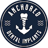 Anchored Dental Implant Studio Dental Implant