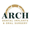 Arch Dental Implants & Oral Surgery Dental Implant