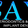 Bay Periodontics & Implant Dentistry, Pc Dental Implant