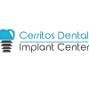 Cerritos Dental Implant Center Dental Implant