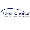 Clearchoice Dental Implant Center Dental Implant