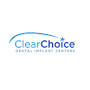 Clearchoice Dental Implant Center Dental Implant