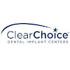 Clearchoice Dental Implant Center Dental Implant