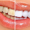 Connecticut Dental Group- M. Azar Dds Dental Implant