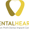 Dental Hearts Dental Implant