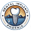 Dental Implants Phoenix Dental Implant