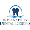 Indianapolis Dental Designs Dental Implant