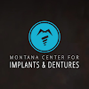 Montana Center For Implants And Dentures Dental Implant