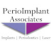 Perioimplant Associates - New Albany, In Dental Implant