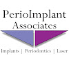 Perioimplant Associates Dental Implant