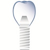 South Florida Periodontics And Dental Implants Dental Implant