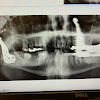 Southwest Oral Surgery & Dental Implants Dental Implant